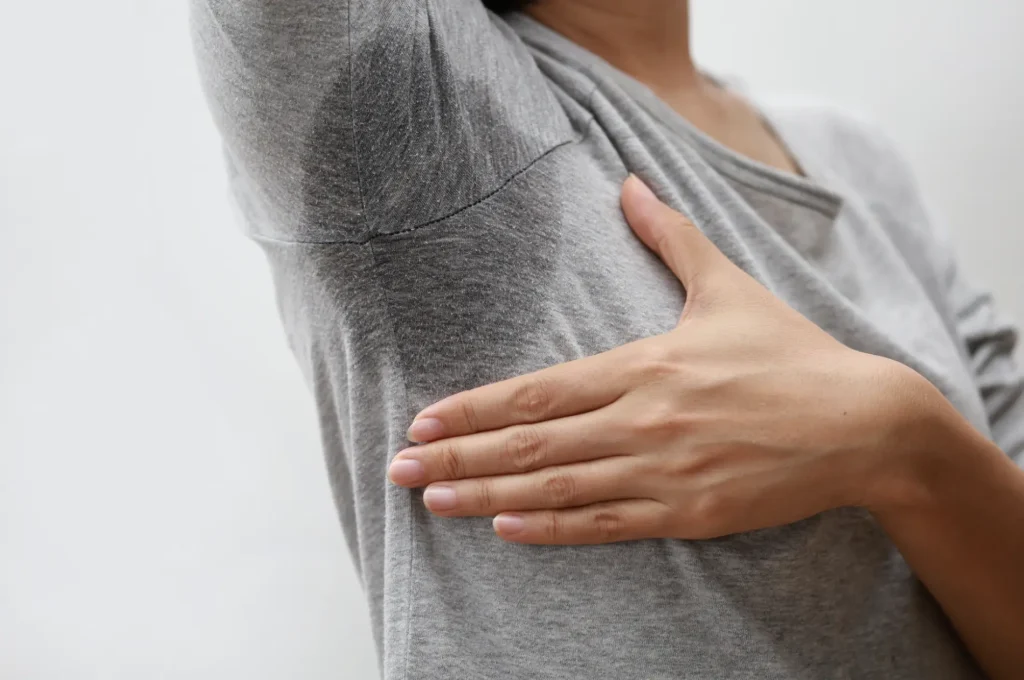 Hyperhidrosis (excessive sweating) treatment