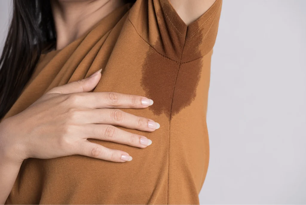 Hyperhidrosis (excessive sweating)