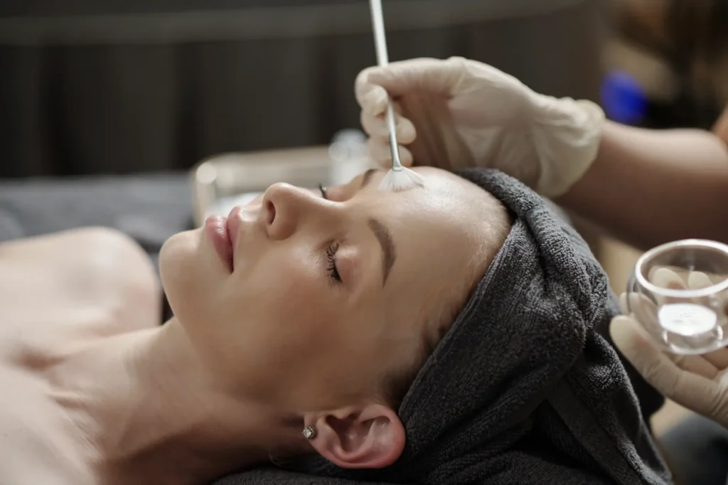 Facial chemical peel