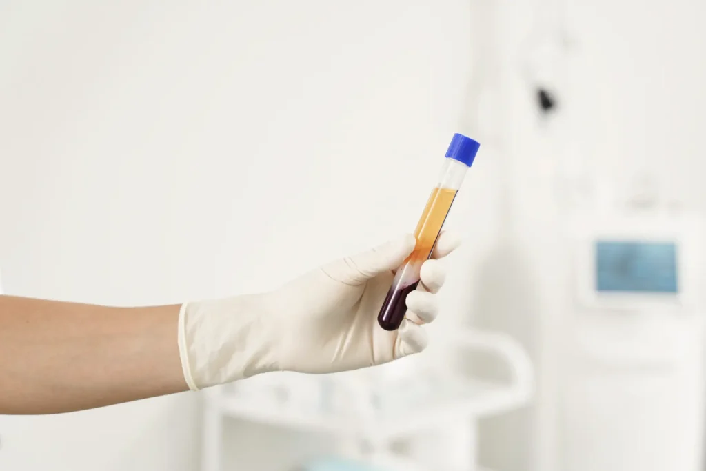 Platelet-rich plasma (PRP)