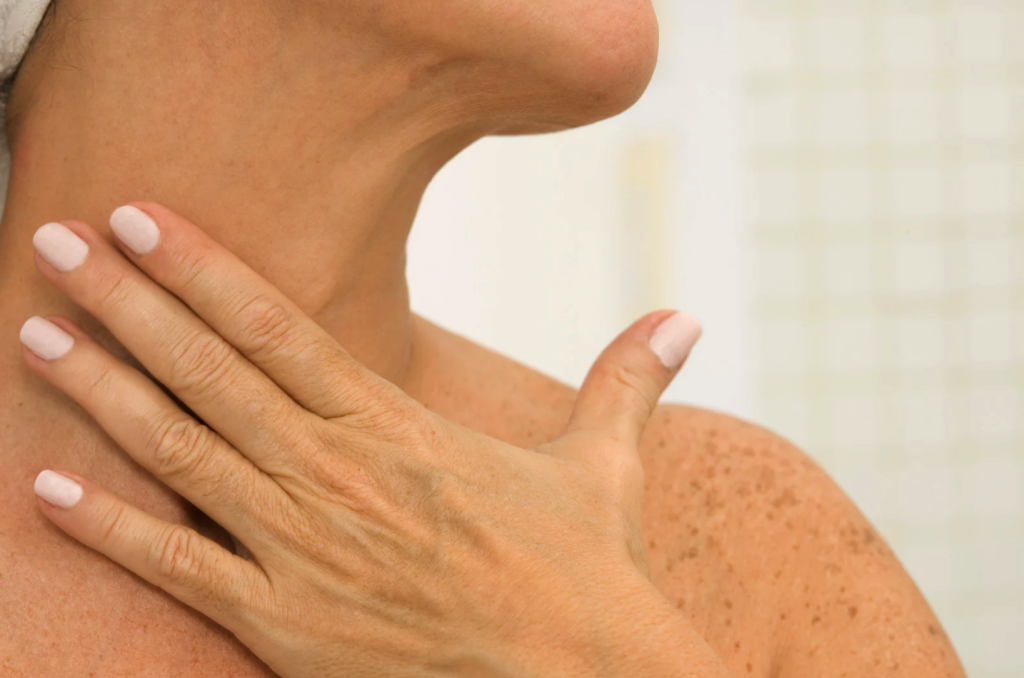 Neck, décolleté and hand rejuvenation