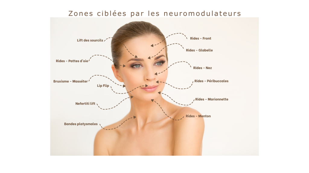 Zones du visage traitées par neuromodulateurs